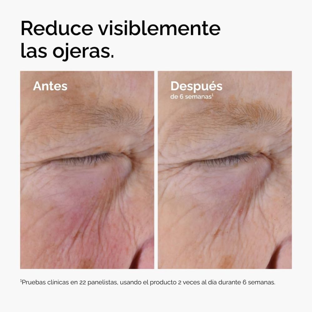 CAFFEINE SOLUTION 5% + EGCGC (SUERO PARA CONTORNO DE OJOS CON CAFE&Iacute;NA)